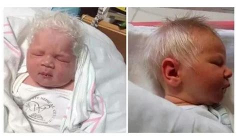 AMAZING STORIES AROUND THE WORLD: Doctors Explains Why Baby Was Born ...