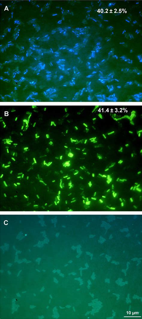 Microscopic image of E. coli from three days' culture in LB medium: A)... | Download Scientific ...