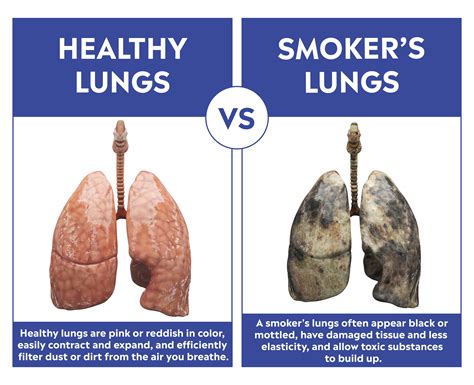 Pot Smokers Lungs Vs Healthy Lungs