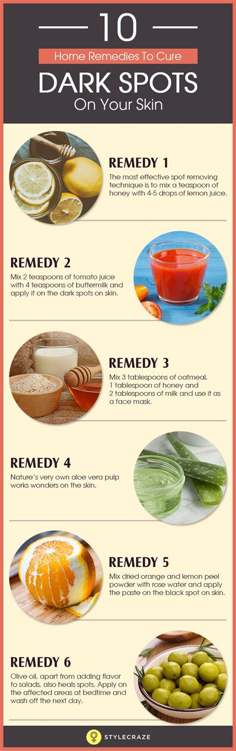 10 Natural Remedies For Curing Dark Spots On Your Skin Infographic – NaturalON - Natural Health ...