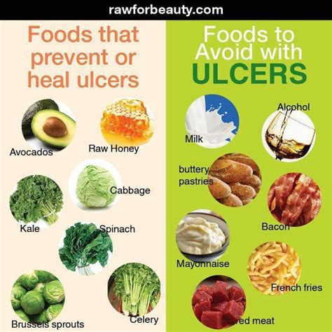 Duodenal Ulcer Diet Treatment - dotgala