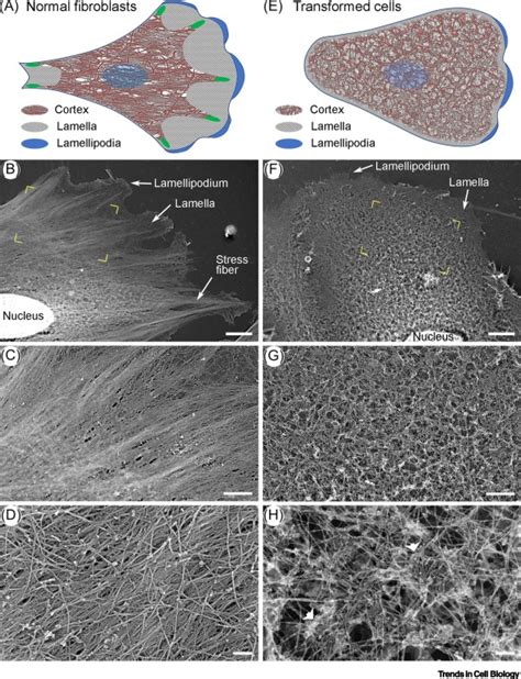 Microfilaments Electron Microscopy