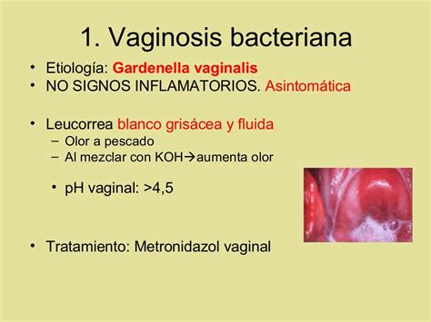 Vulvovaginitis