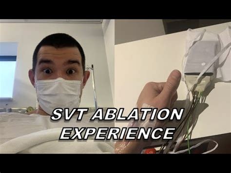 My SVT Surgery Experience | Catheter Ablation - YouTube