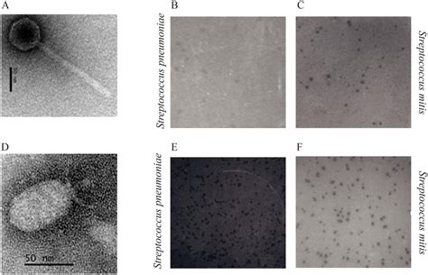 Electron microscopy of virulent phage Dp-1 (A) and phage SOCP ...