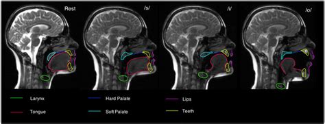 Configurations of the vocal tract This figure shows images from a ...