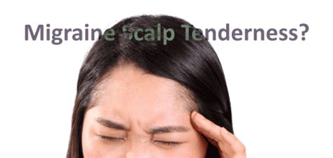 Migraine Scalp Tenderness - Should I be worried? - Headache and Migraine News