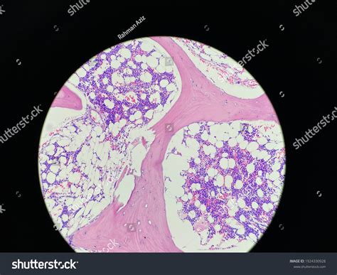 Trephine Biopsy View Under Microscope Pathology Stock Photo 1924330928 ...