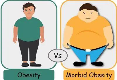 Difference Between Obesity and Morbid Obesity (with Comparison Chart) - Bio Differences