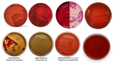 Blood Agar - Preparation, Composition, Application, and limitation - Biology Notes Online