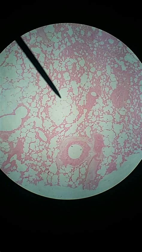 Lung - simple squamous epithelium | Squamous, Tissue types, Simple