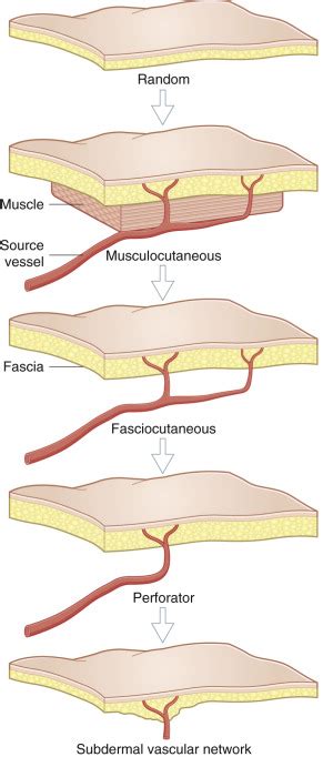 Fasciocutaneous Flaps Overview History Classification