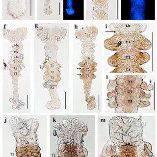 Horseradish peroxidase staining of H. limbata embryos using the... | Download Scientific Diagram