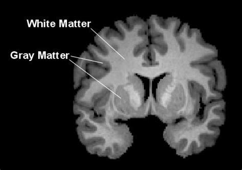 Depiction of Gray and White Ma [IMAGE] | EurekAlert! Science News Releases