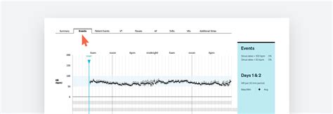 The Zio Service - A Complete Ambulatory Monitoring Solution.