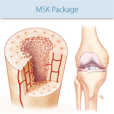 MSK Ultrasound Courses Online - Learn MSK Ultrasound