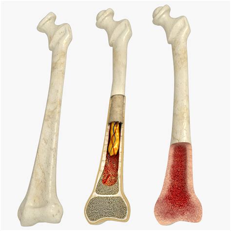 3d Model Bone Marrow Anatomy Turbosquid 1739292 | Free Hot Nude Porn ...