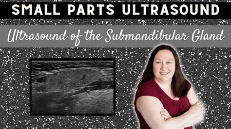 Small Parts Ultrasound | Ultrasound of the Submandibular Gland - YouTube