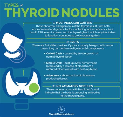 How to Shrink Thyroid Nodules - Dr. Izabella Wentz