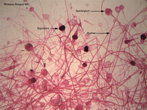 Zygomycota - Dr. Peat's Biology Page