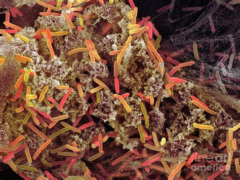 Pseudomonas Aeruginosa Bacteria #2 Photograph by Science Photo Library - Fine Art America