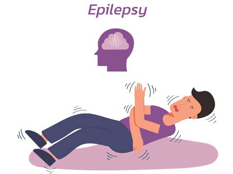 Epilepsy Surgery- Procedure, Success Rate, & Cost In India