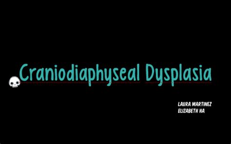 Craniodiaphyseal Dysplasia by Elizabeth Ha on Prezi