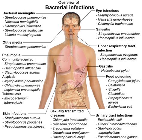 Infection and Disease - MICRO-PARA YOU KNOW!