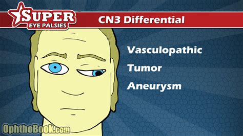 Cranial Nerve Palsies (Video) - TimRoot.com