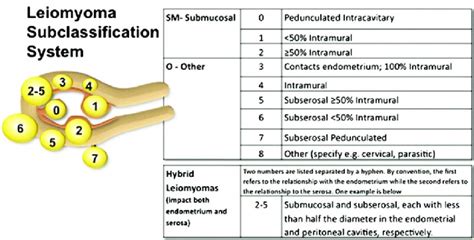 The FIGO myoma subclassification system Source: Munro MG, Critchley HO,... | Download Scientific ...