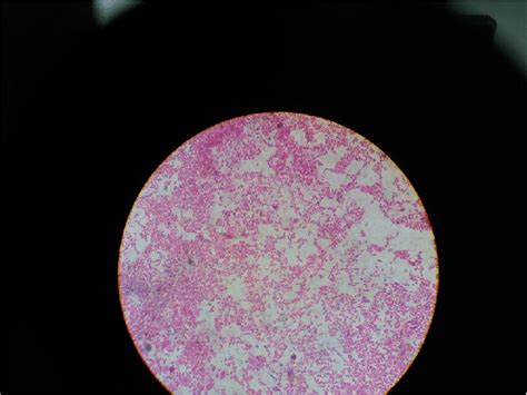 Gram negative bacilli were seen in the gram stain with bipolar staining... | Download Scientific ...