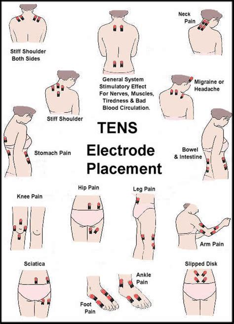 TENS Unit Electrode Placement Guide - prohealthcareproducts.com