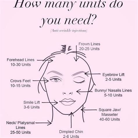 Approximately how many units of Botox are generally recommended. Anti ...