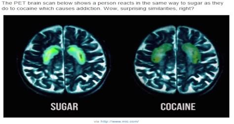 Science Explains: What Sugar Does to Your Brain | Factual Facts