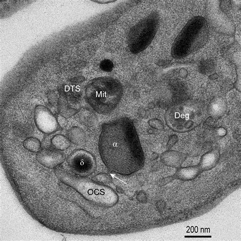 Transmission Electron Microscopy of Platelets FROM Apheresis and Buffy ...