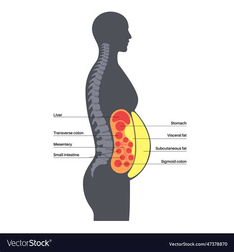 Visceral fat diagram Royalty Free Vector Image