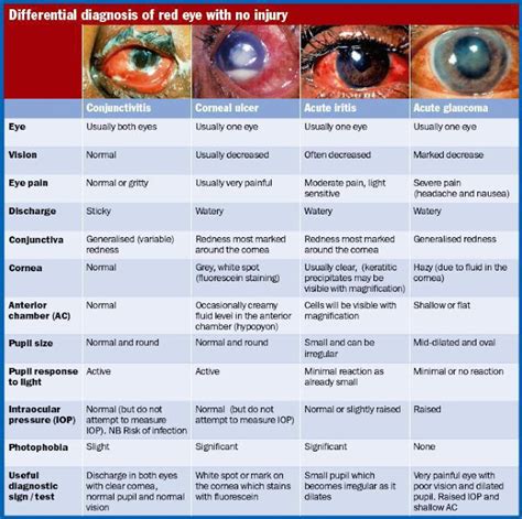 PLAB king: Acute Red Eye (807/1700)