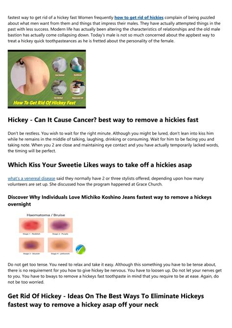 PPT - How Do You Get Rid Of A Hickey Quick ways to treat a hickey in a ...