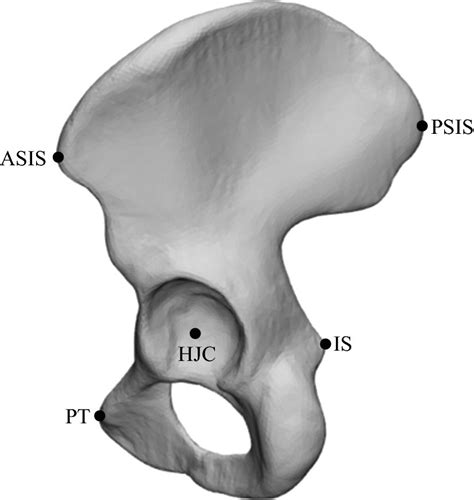 Asis Anterior Superior Iliac Spine