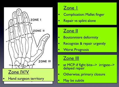 Hand Zones – Closing the Gap