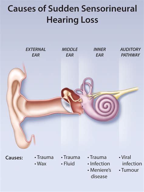 Hyperbaric Oxygen Therapy (HBOT) for Sudden Sensorineural Hearing Loss | Oxygen Oasis