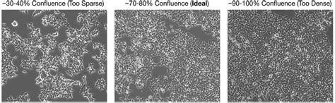 AAV Production in HEK293T Cells