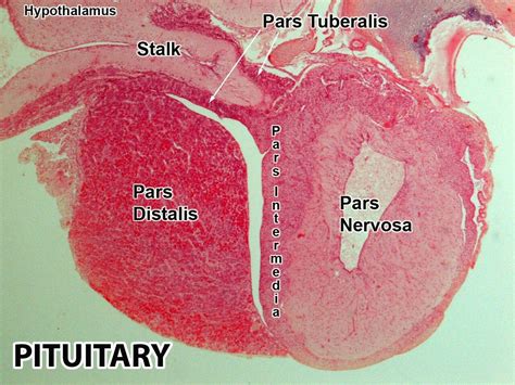 Anterior and posterior pituitary including pars nervosa of the posterior pituitary … | Anatomy ...