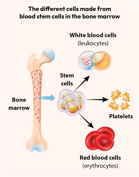 Inherited Bone Marrow Failure Syndromes