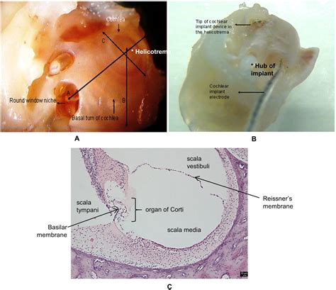 Basilar Membrane Histology