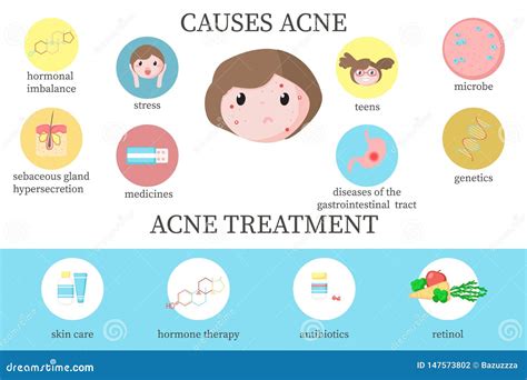 Acne Causes and Treatment Diagram, Vector Flat Illustration Stock Vector - Illustration of acne ...