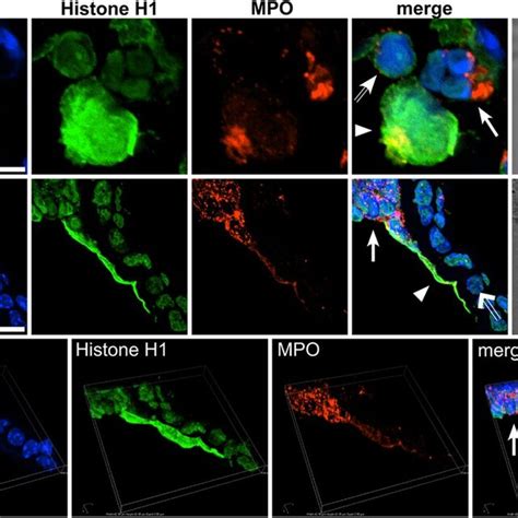 Detection of neutrophil extracellular traps (NETs) by... | Download ...