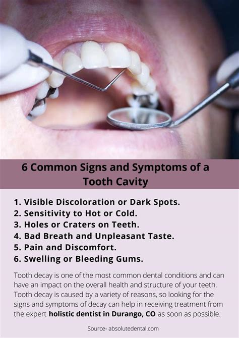 6 Common Signs and Symptoms of a Tooth Cavity by anthonyalfonso - Issuu