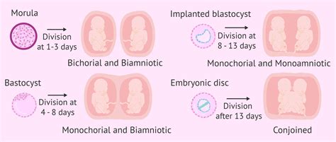 Fraternal Twins Fetal Development