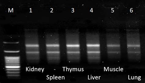 Total RNA Extraction Kit - Tissue